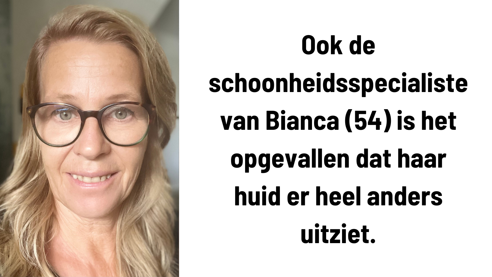 Anouk (52) haar huid is steviger geworden en blijft dat ook (1).png