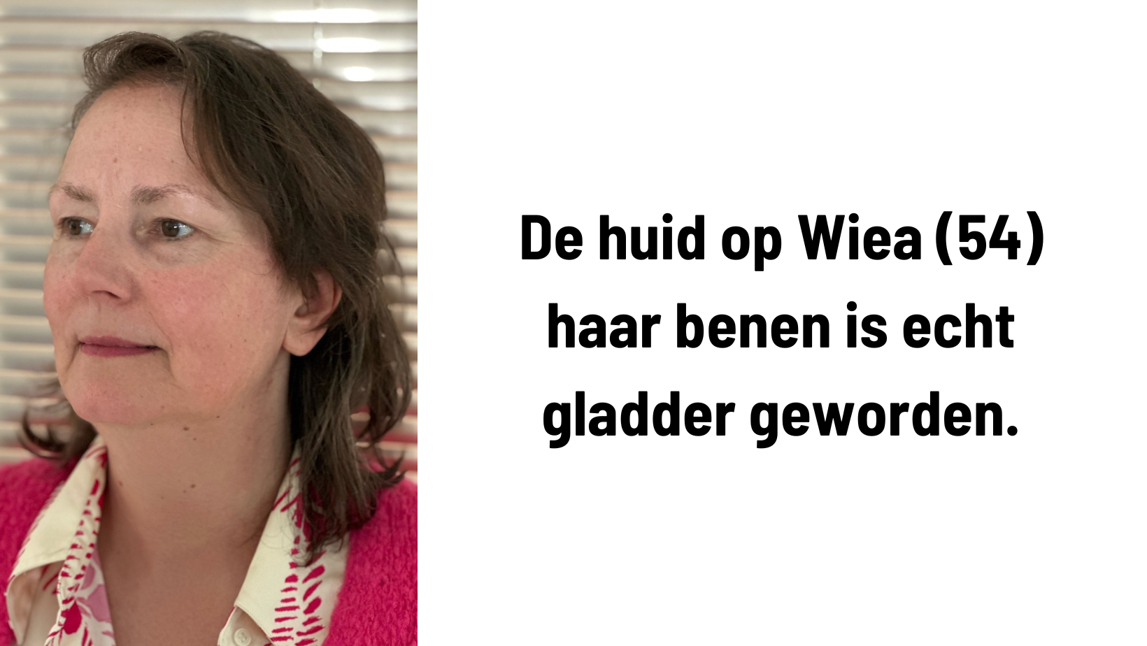 Anouk (52) haar huid is steviger geworden en blijft dat ook (5).png